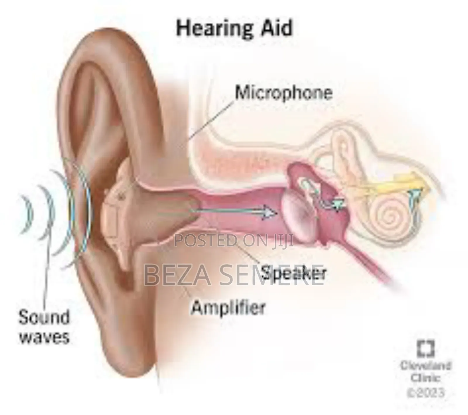 Rechargeable Hearing Aid