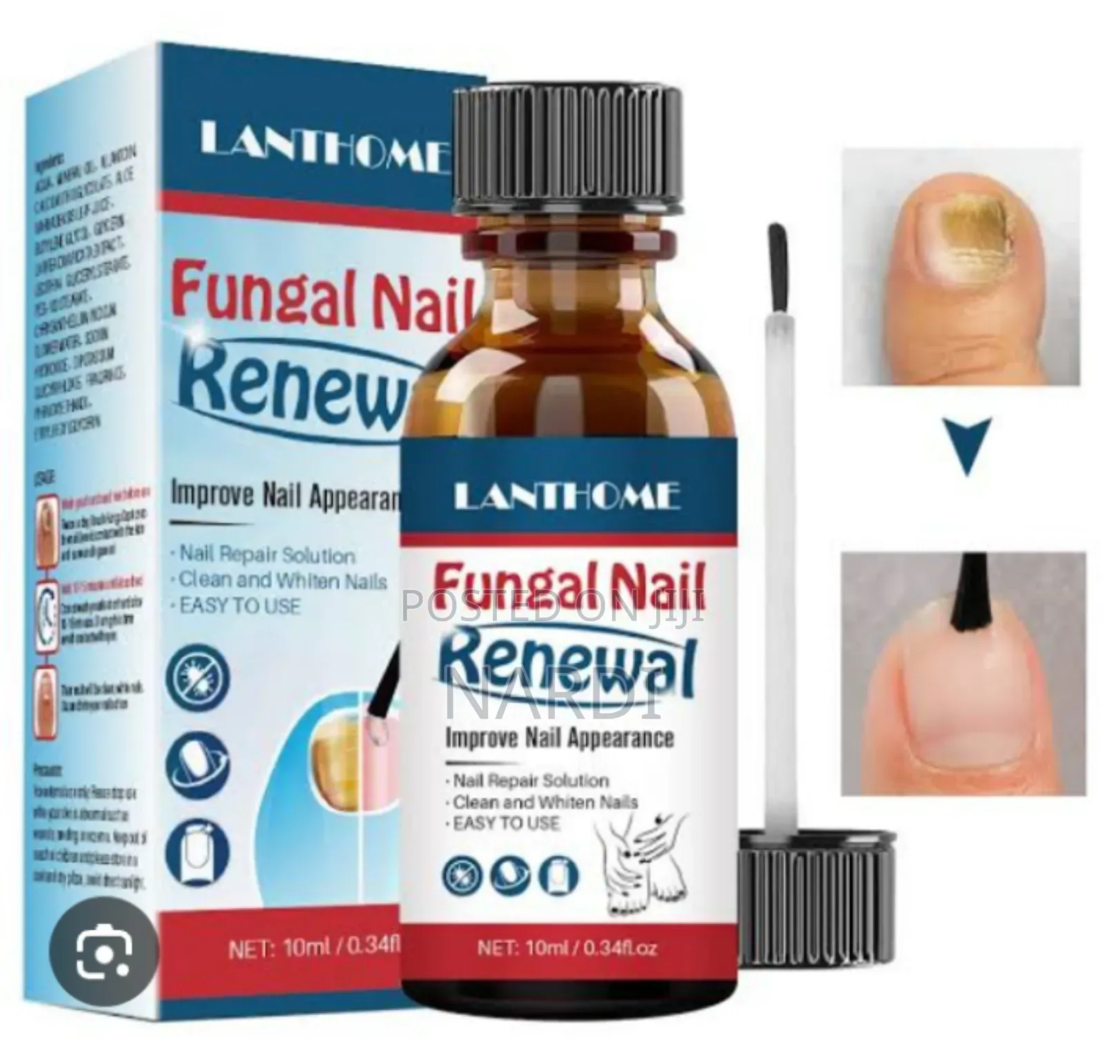 Fungai Nail Renewal (Lanthome)