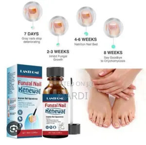 Fungai Nail Renewal (Lanthome)