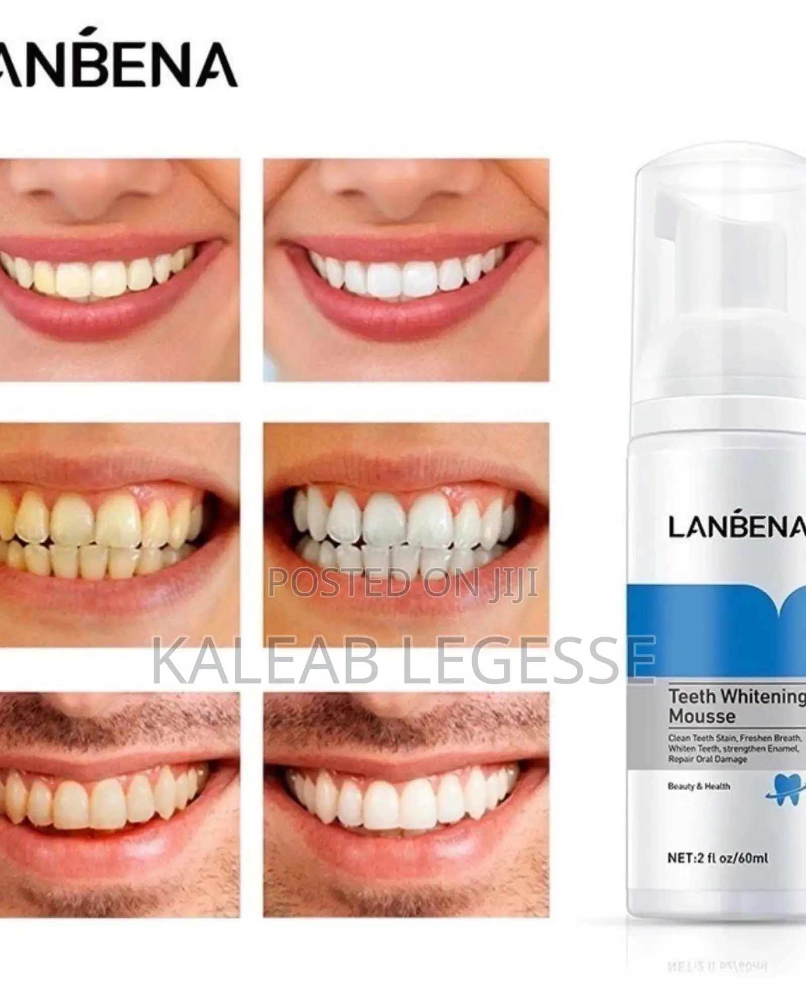 Lanbena Teeth Whitening