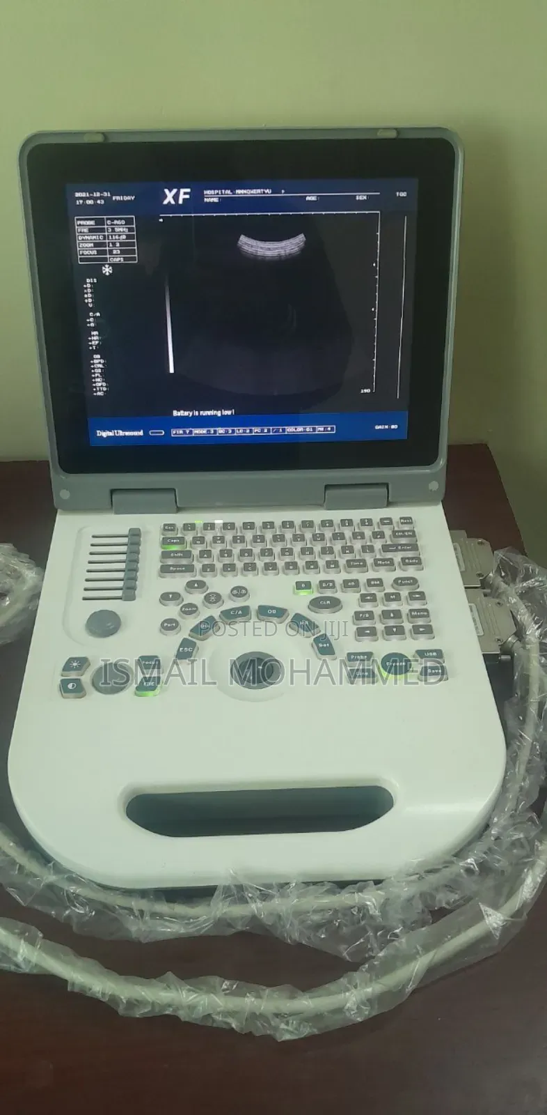 Xf Pro50 Ultrasound