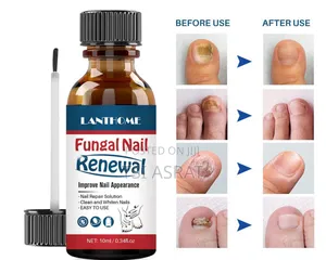 Photo - Lanthome Fungai Nail Renewal