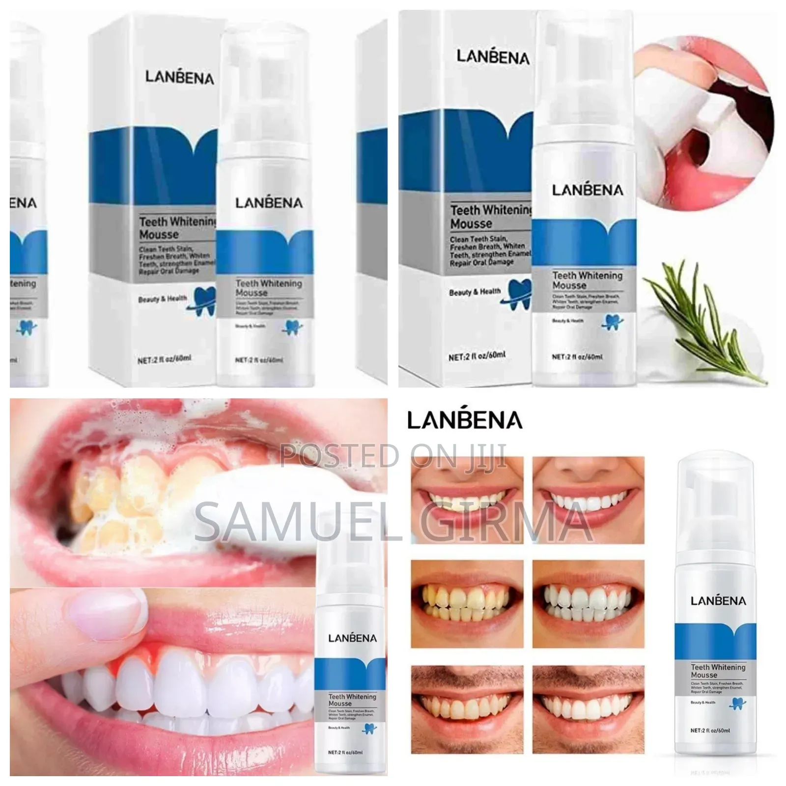 Lanbena Teeth Whitening