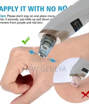 Multifunctional Blackhead Remover