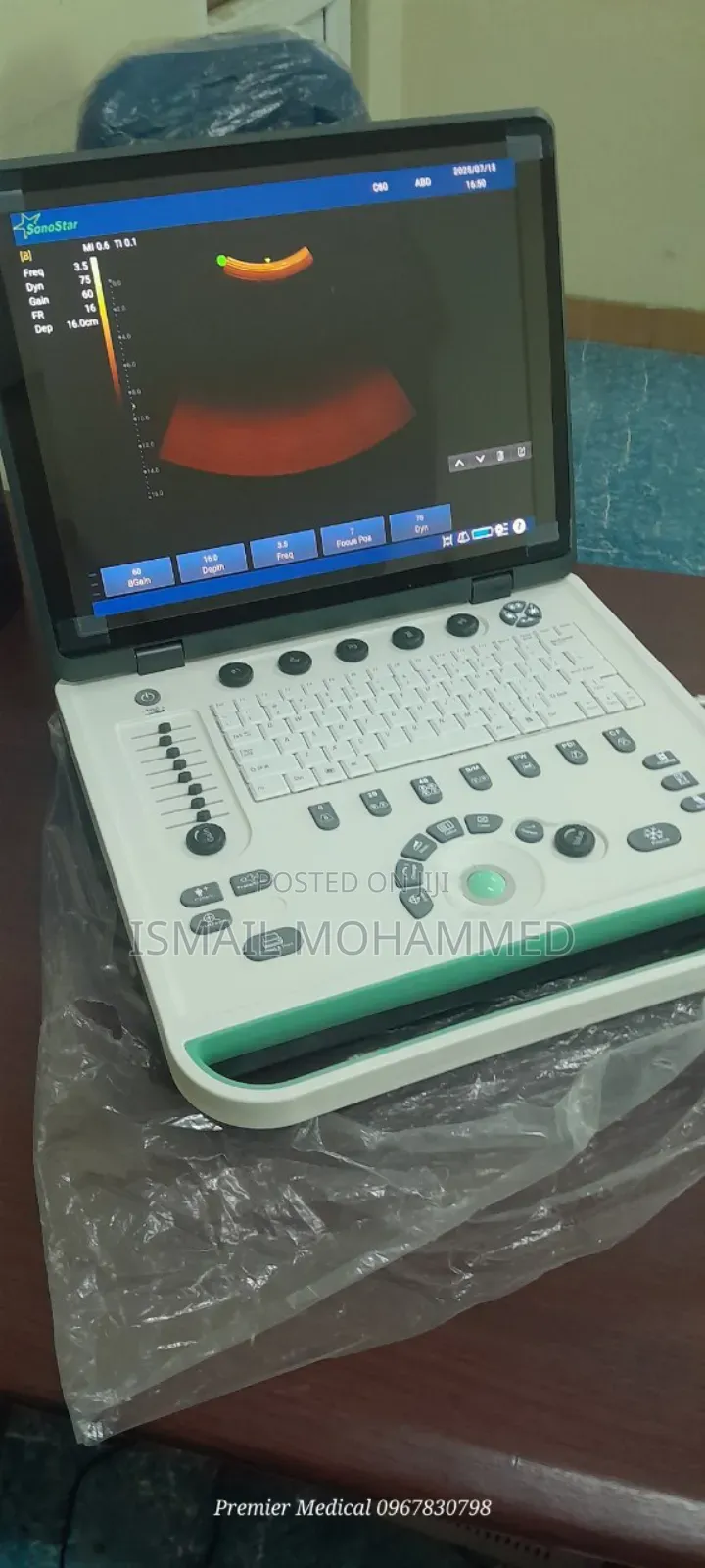 Color Doppler Ultrasound
