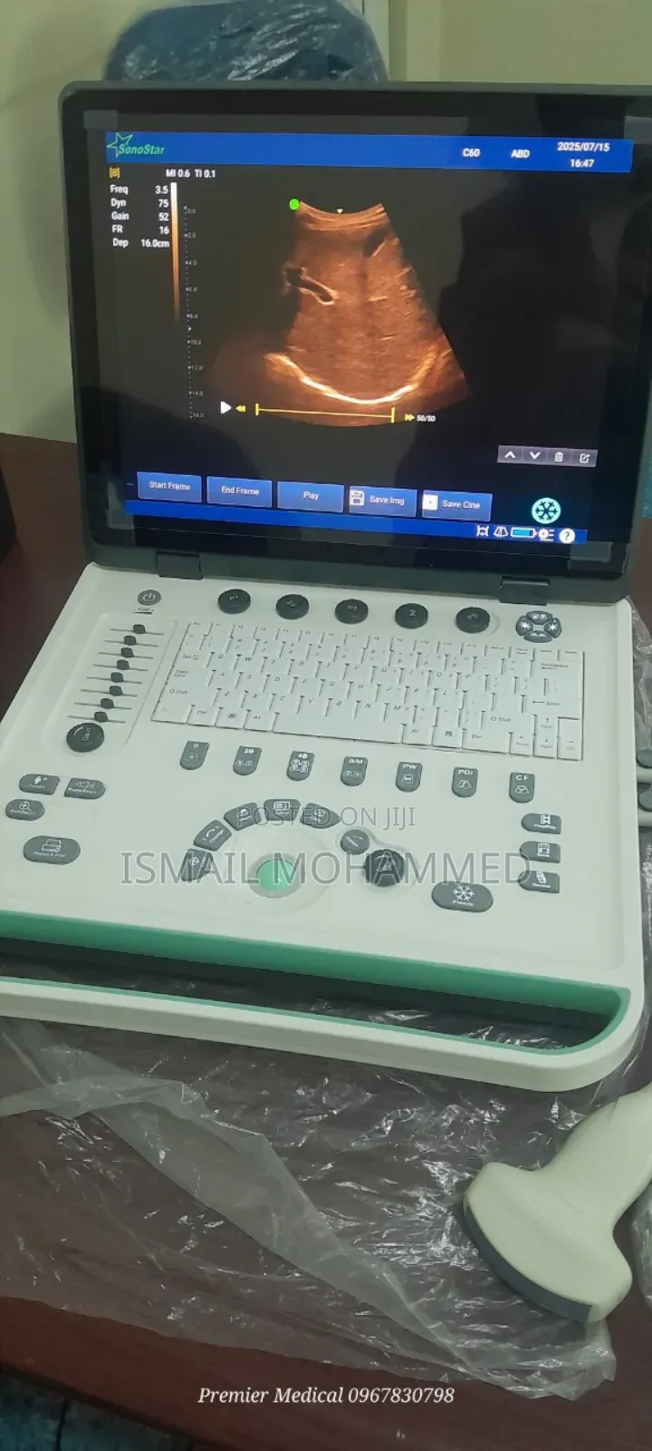 Color Doppler Ultrasound