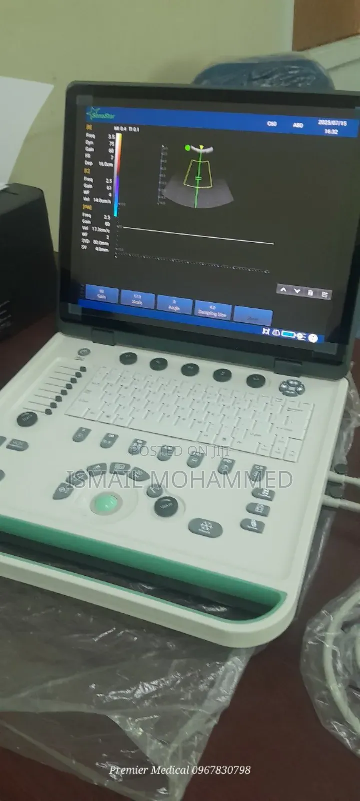 Color Doppler Ultrasound