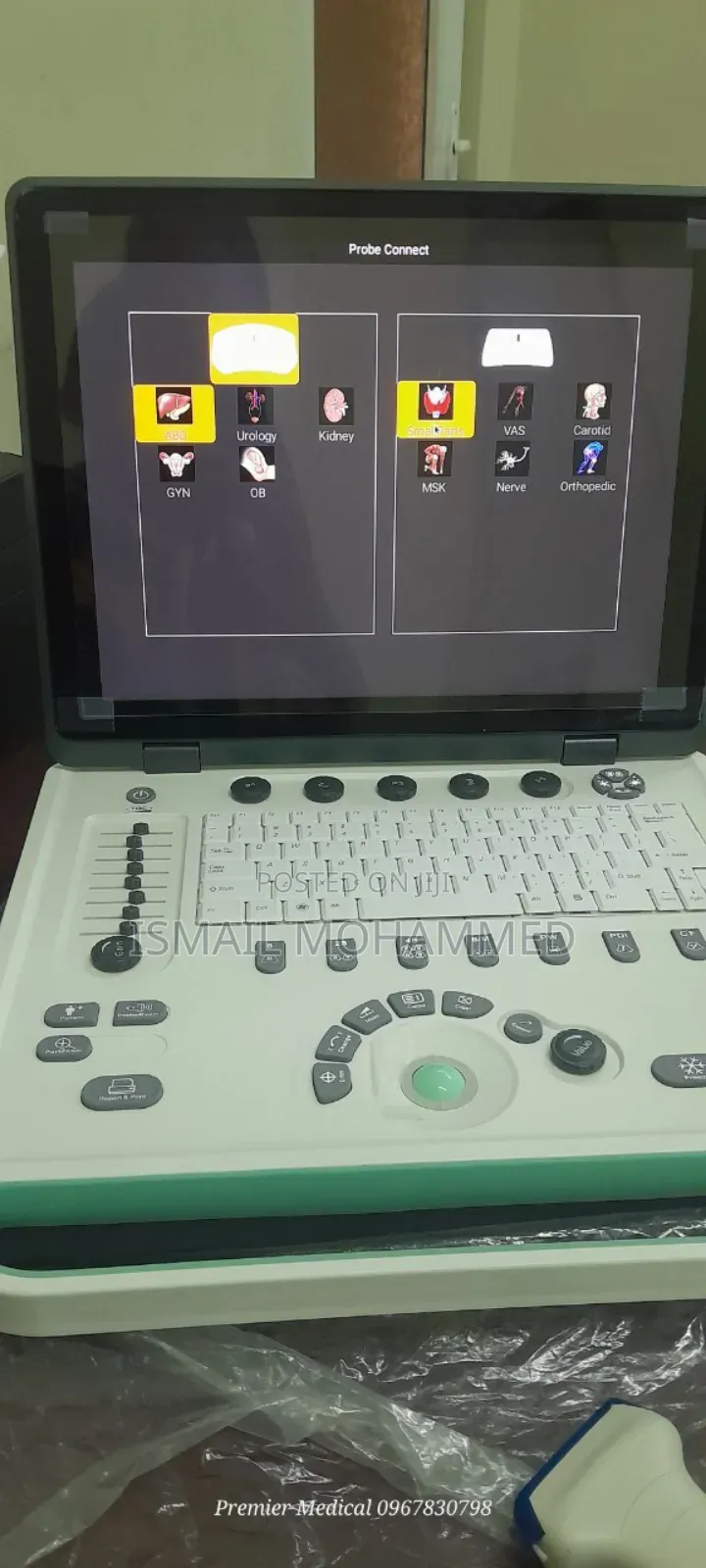 Color Doppler Ultrasound