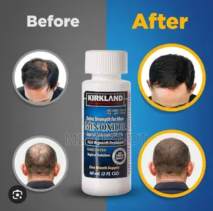 Minoxidil 5% for Men 
