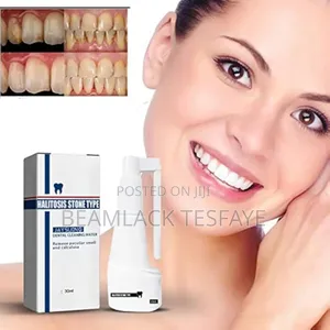 Photo - Dental Calculus Oral Spray