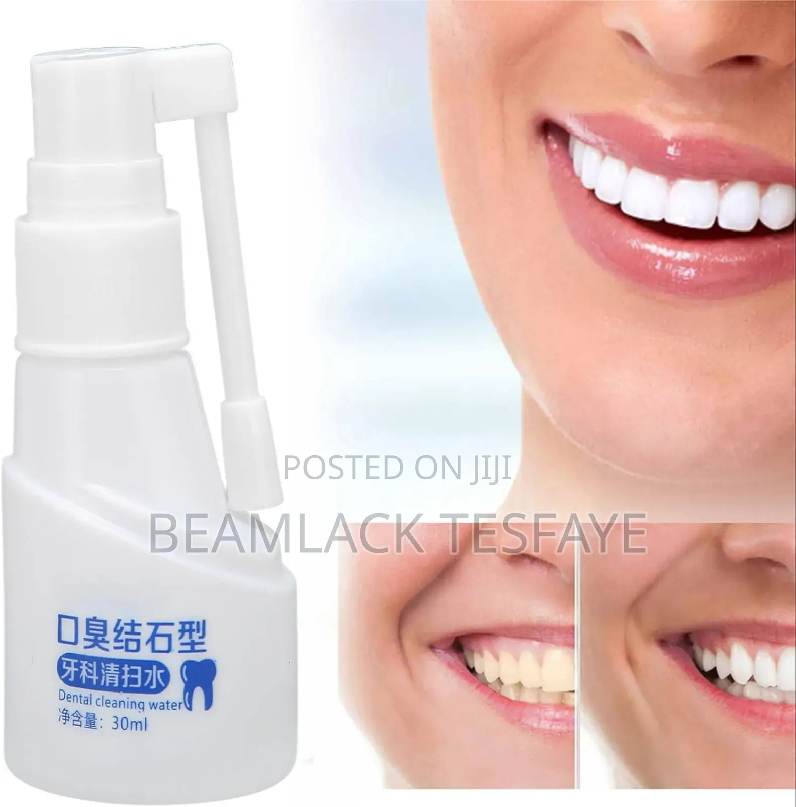 Dental Calculus Oral Spray