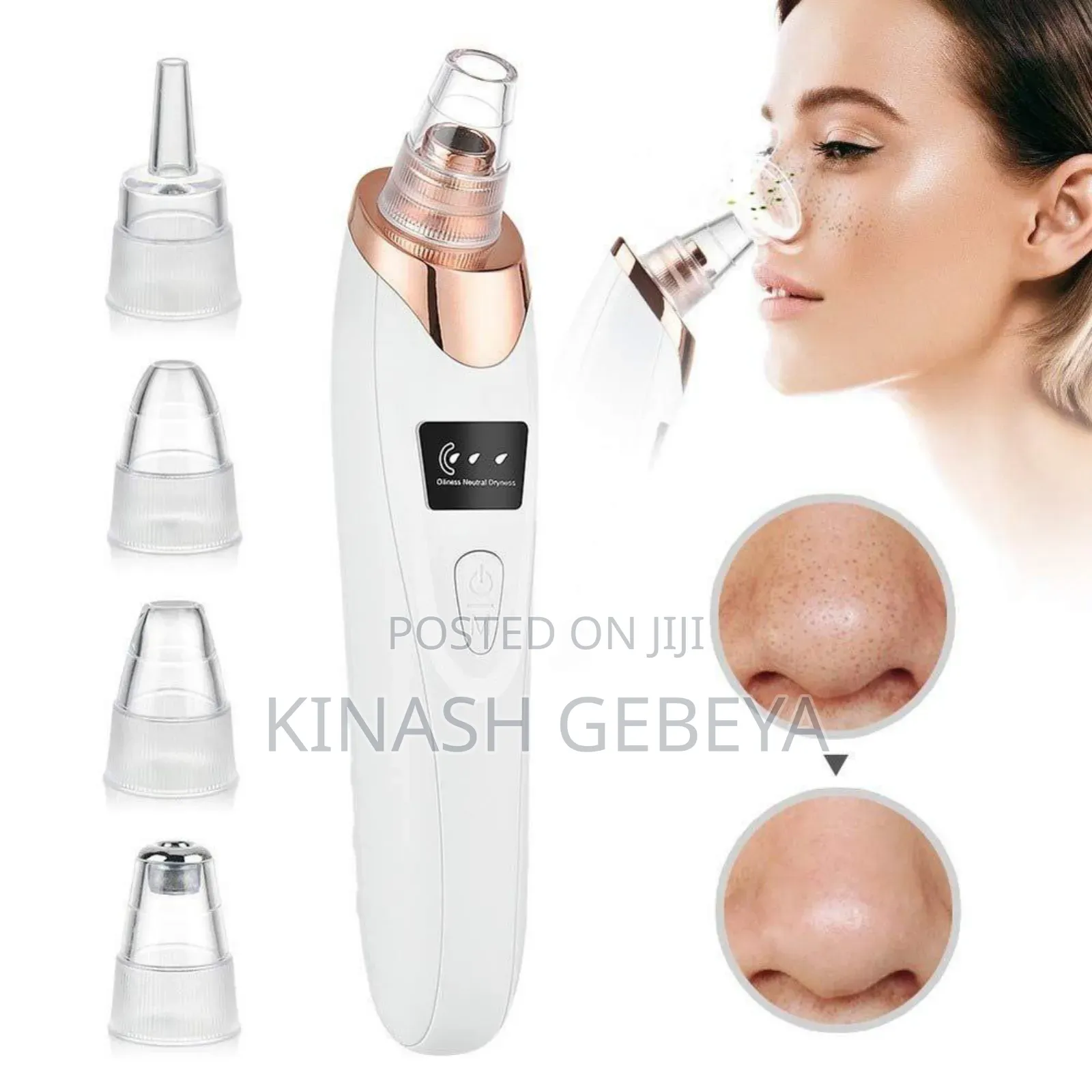 Multifunctional Black Head Remover(የፊት ቆዳ ማፅጃ)