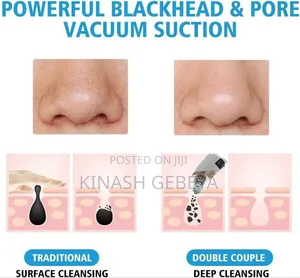 Multifunctional Black Head Remover(የፊት ቆዳ ማፅጃ)