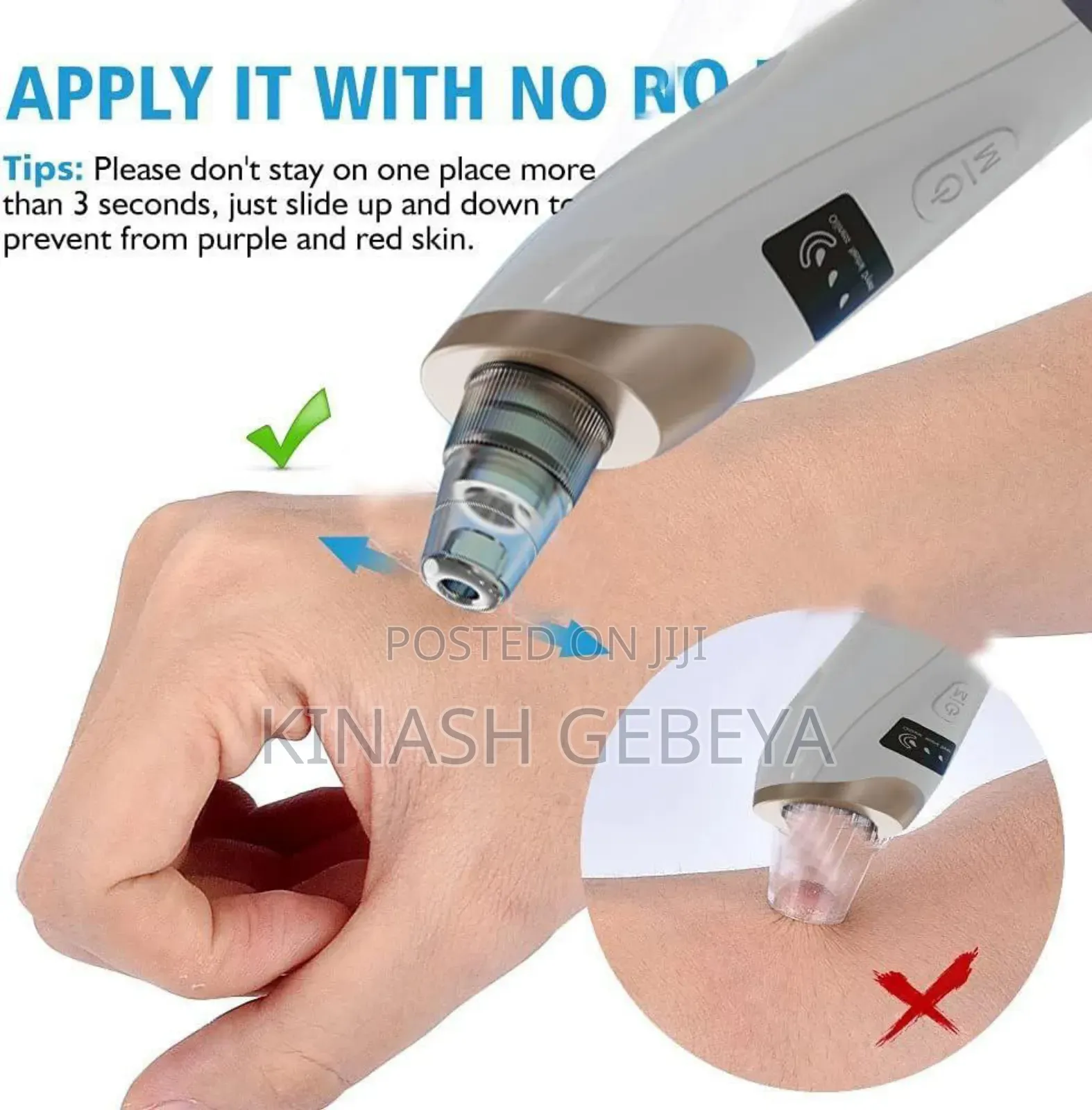 Multifunctional Black Head Remover(የፊት ቆዳ ማፅጃ)
