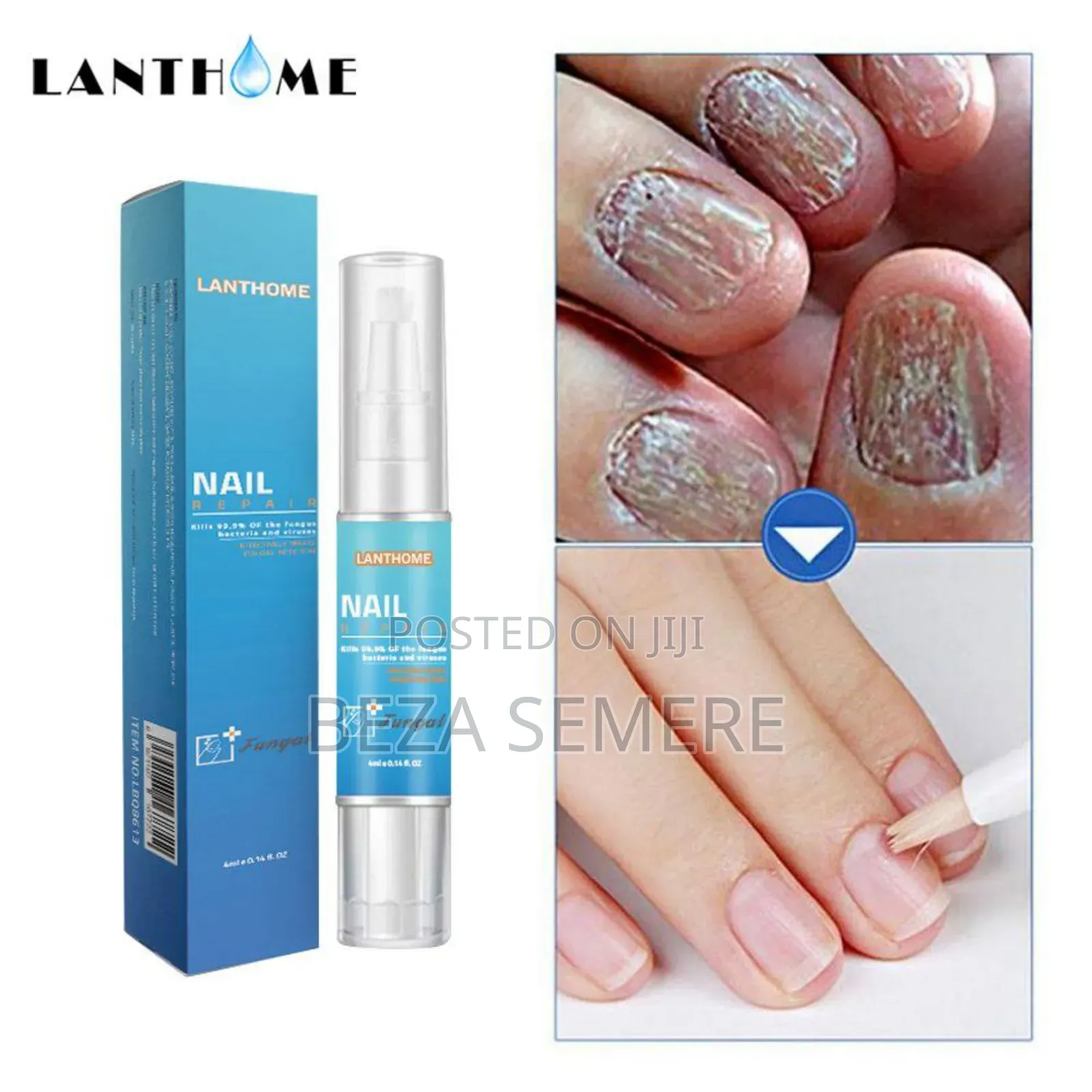 Lanthome Nail Repair