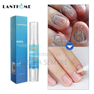 Photo - Lanthome Nail Repair