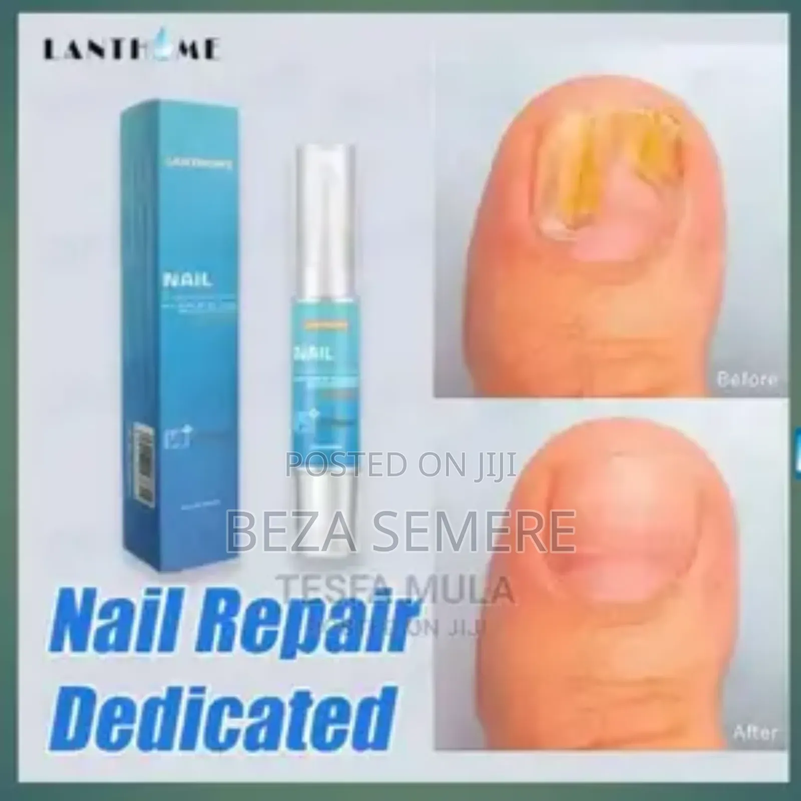 Lanthome Nail Repair High Quality _