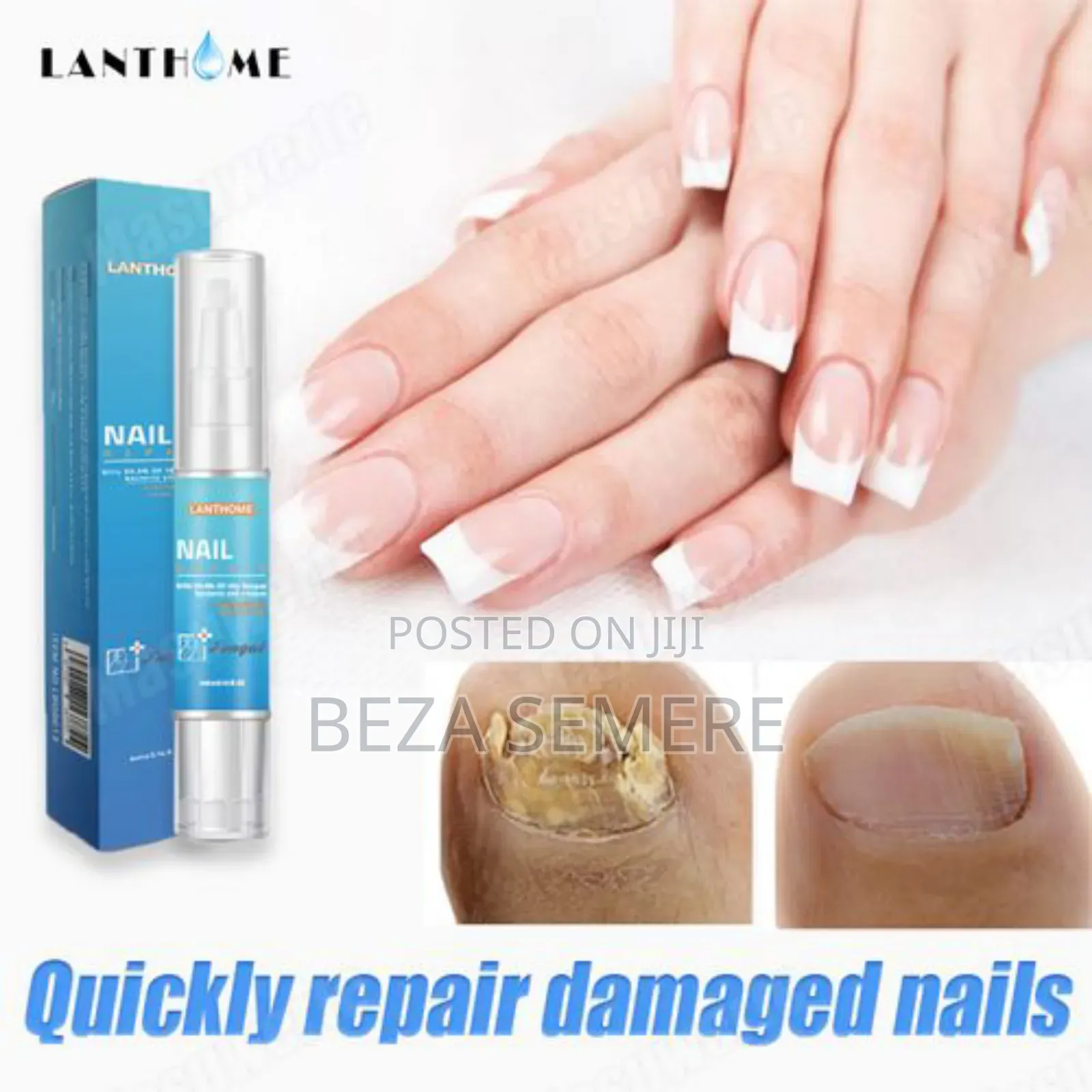 Ultra Lanthome Nail Repair