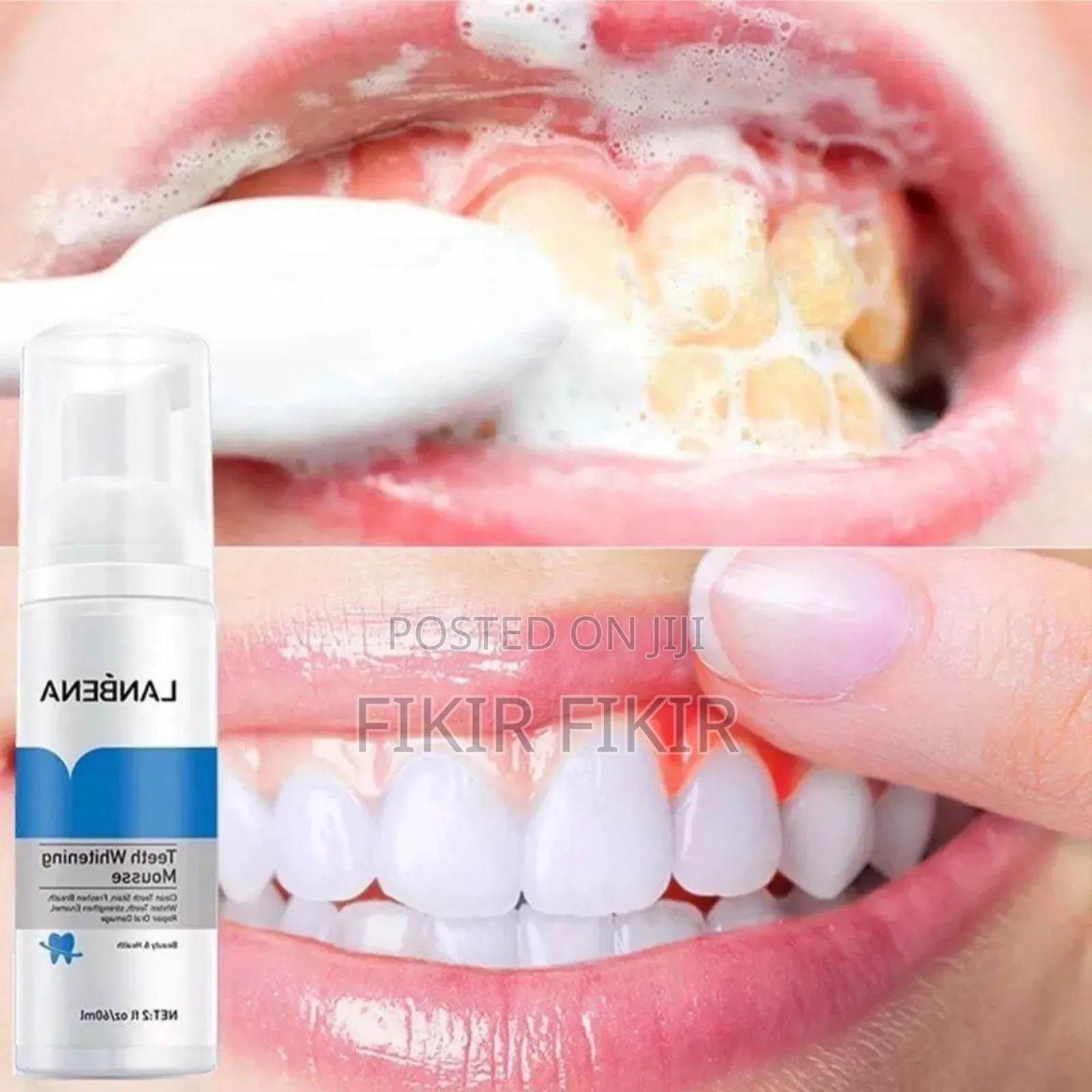 Lanbena Teeth Whitening