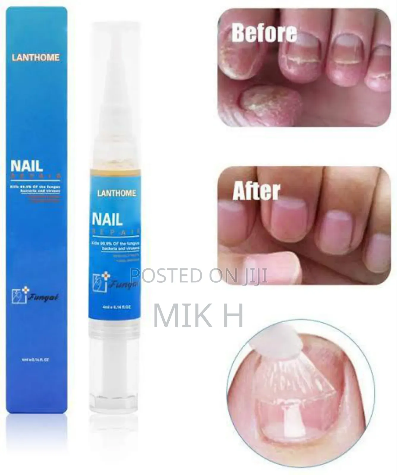 Lanthom የጥፍር ማከሚያ