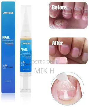 Photo - Lanthom የጥፍር ማከሚያ