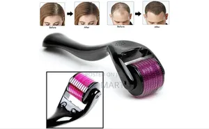 Photo - Derma Roller System 0.5mm With 540 Micro Needles