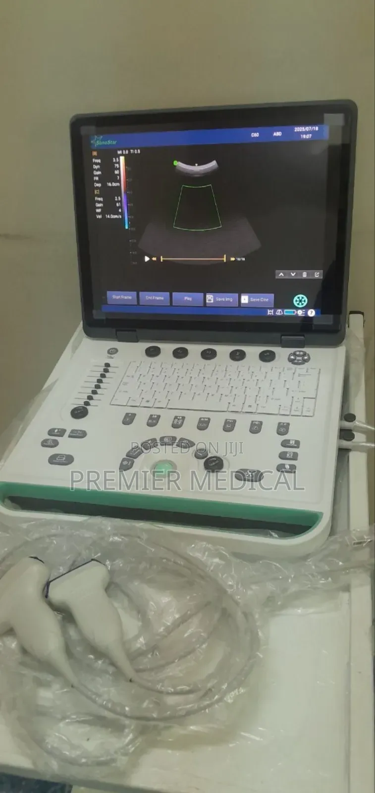 Color Doppler Ultrasound Machine