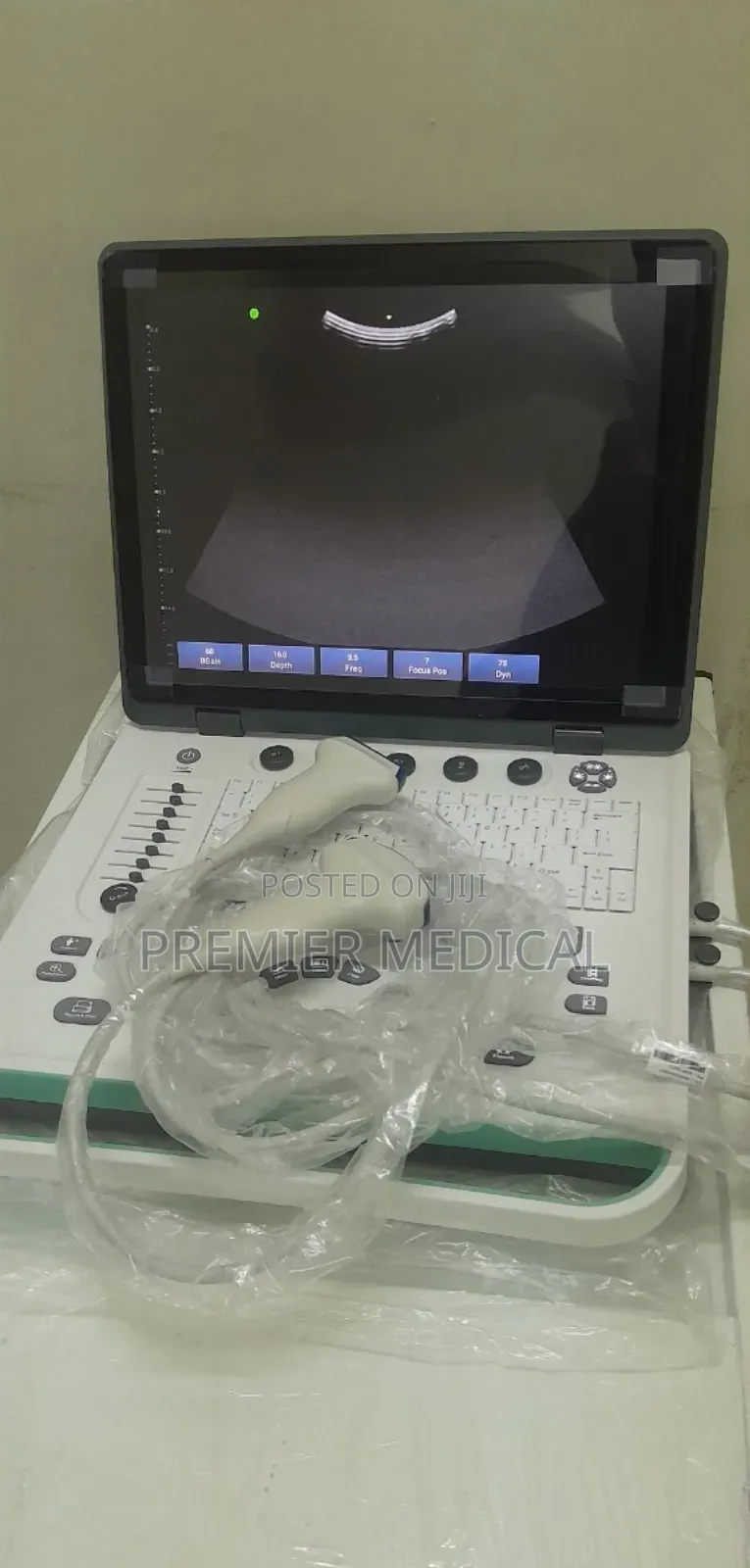 Color Doppler Ultrasound Machine
