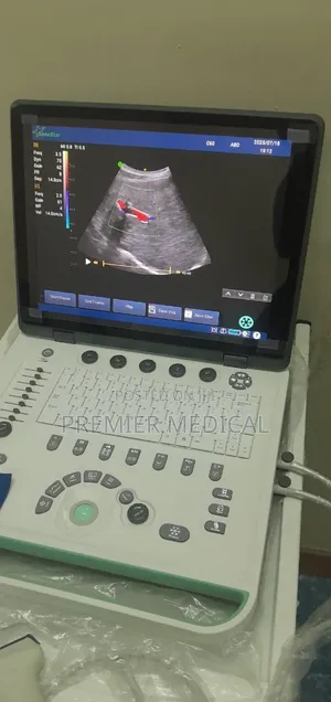 Color Doppler Ultrasound Machine