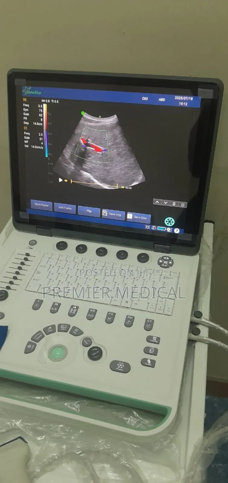 Color Doppler Ultrasound Machine