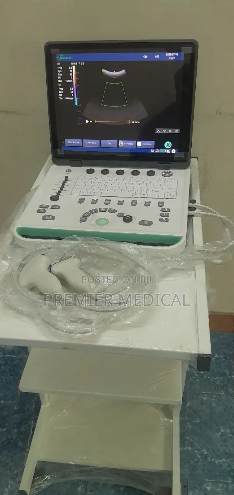 Color Doppler Ultrasound Machine