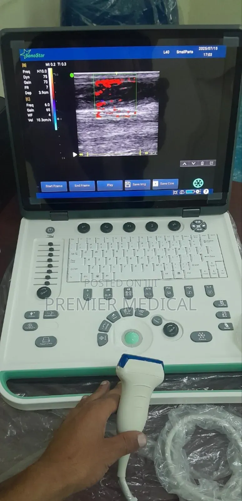 Color Doppler Ultrasound Machine