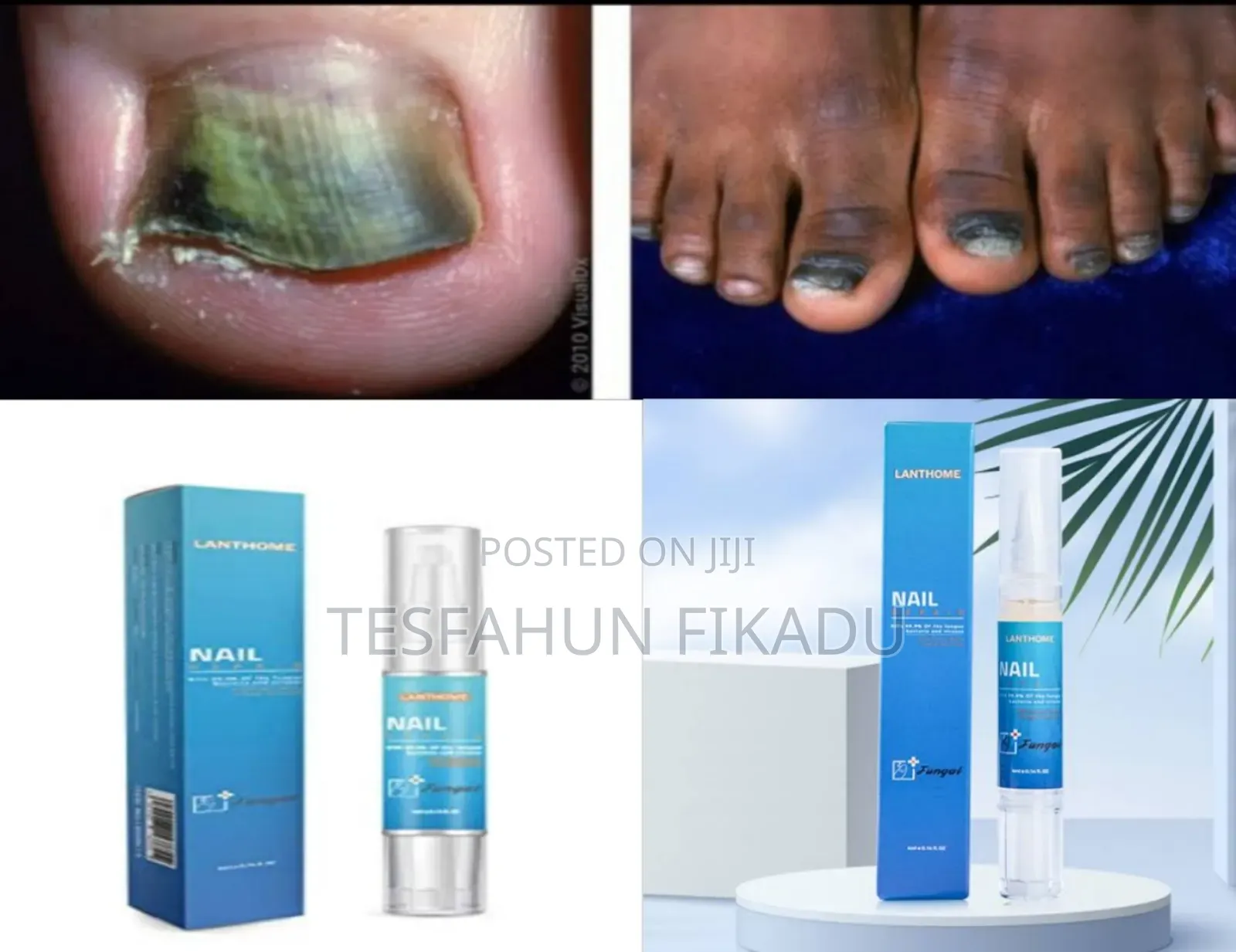 Lanthome Nail Repair