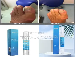 Lanthome Nail Repair