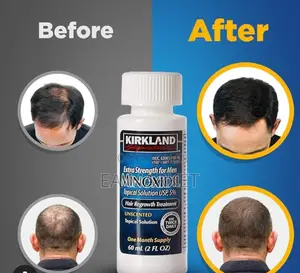 Photo - Minoxidil Usa