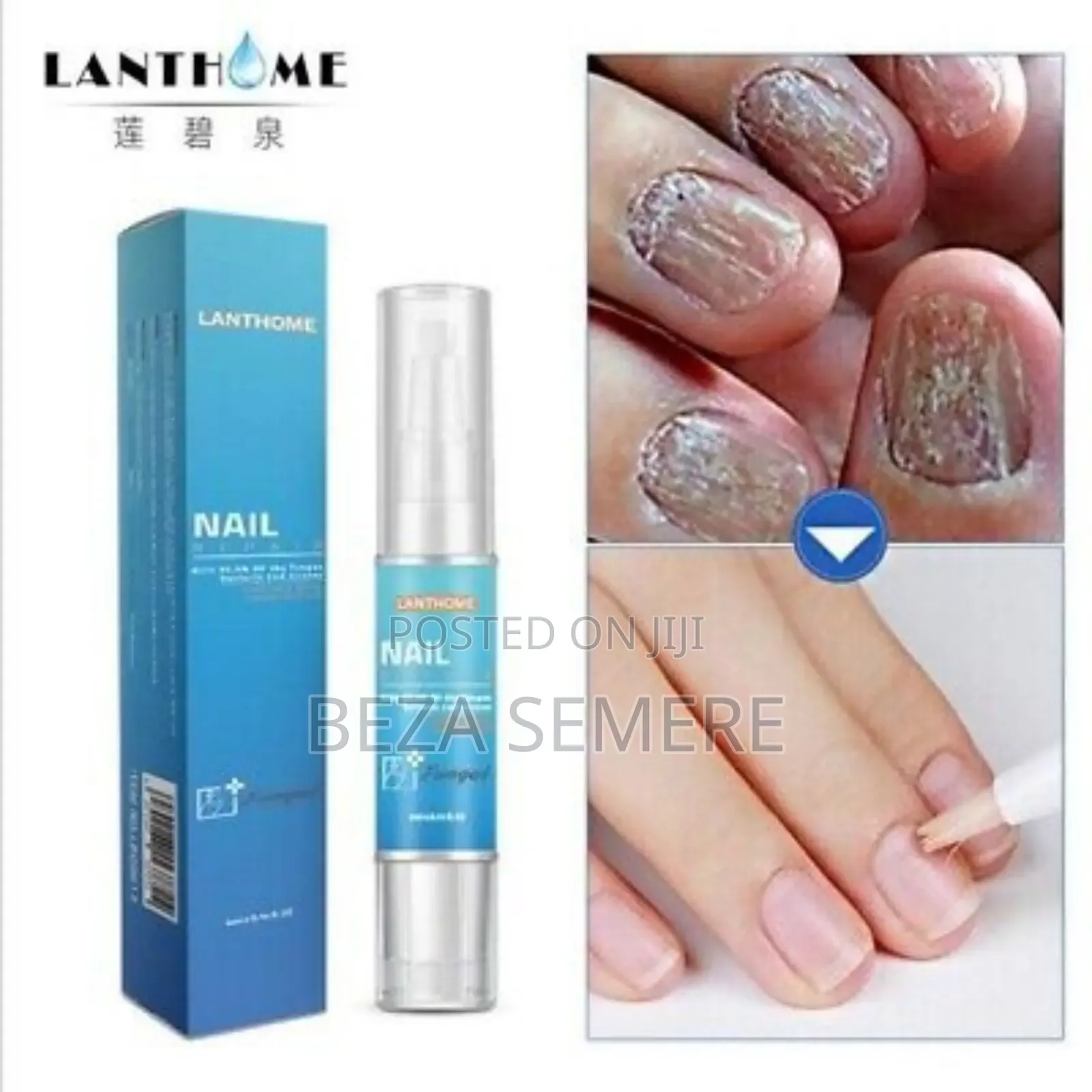 Lanthome Nail Repair Molld