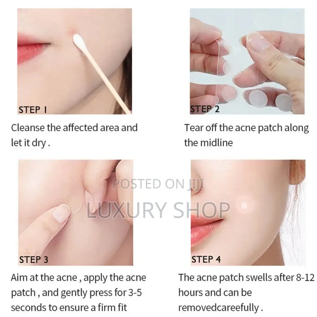 የብጉር ማጥፍያ Acne Patch