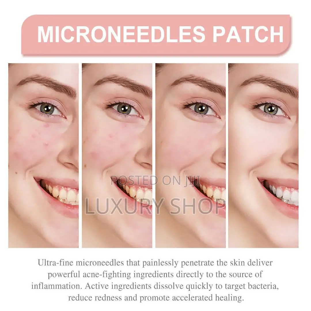 የብጉር ማጥፍያ Acne Patch