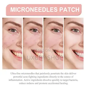 የብጉር ማጥፍያ Acne Patch