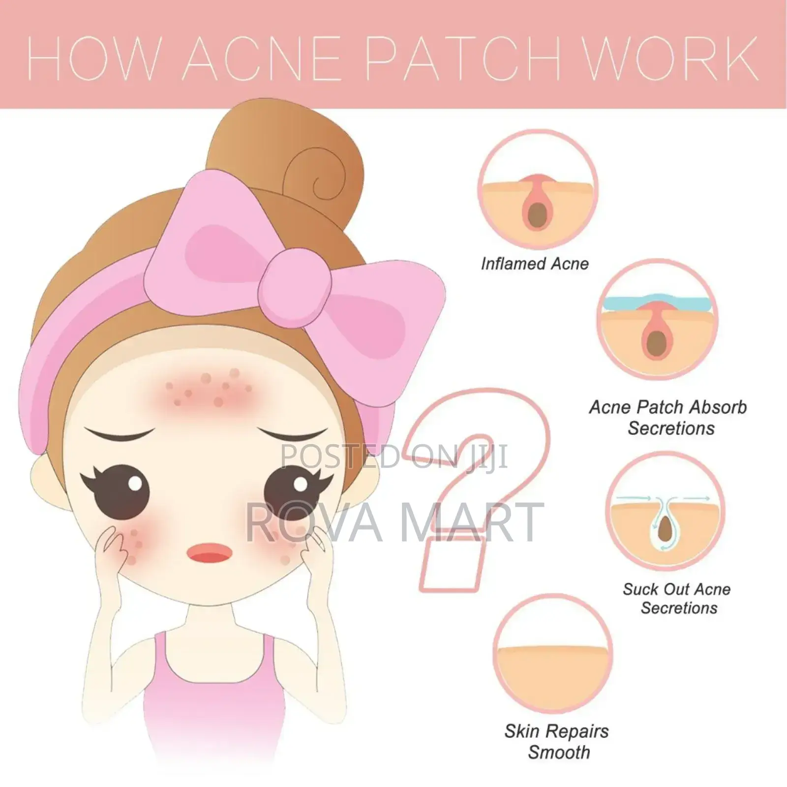 Acne Patch