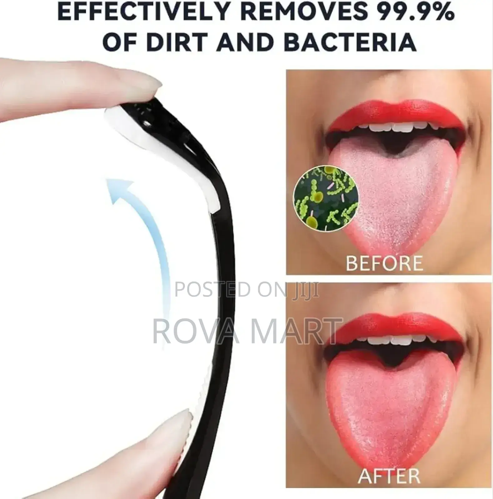 Tongue Cleaner