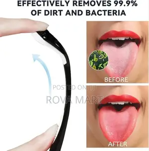 Tongue Cleaner