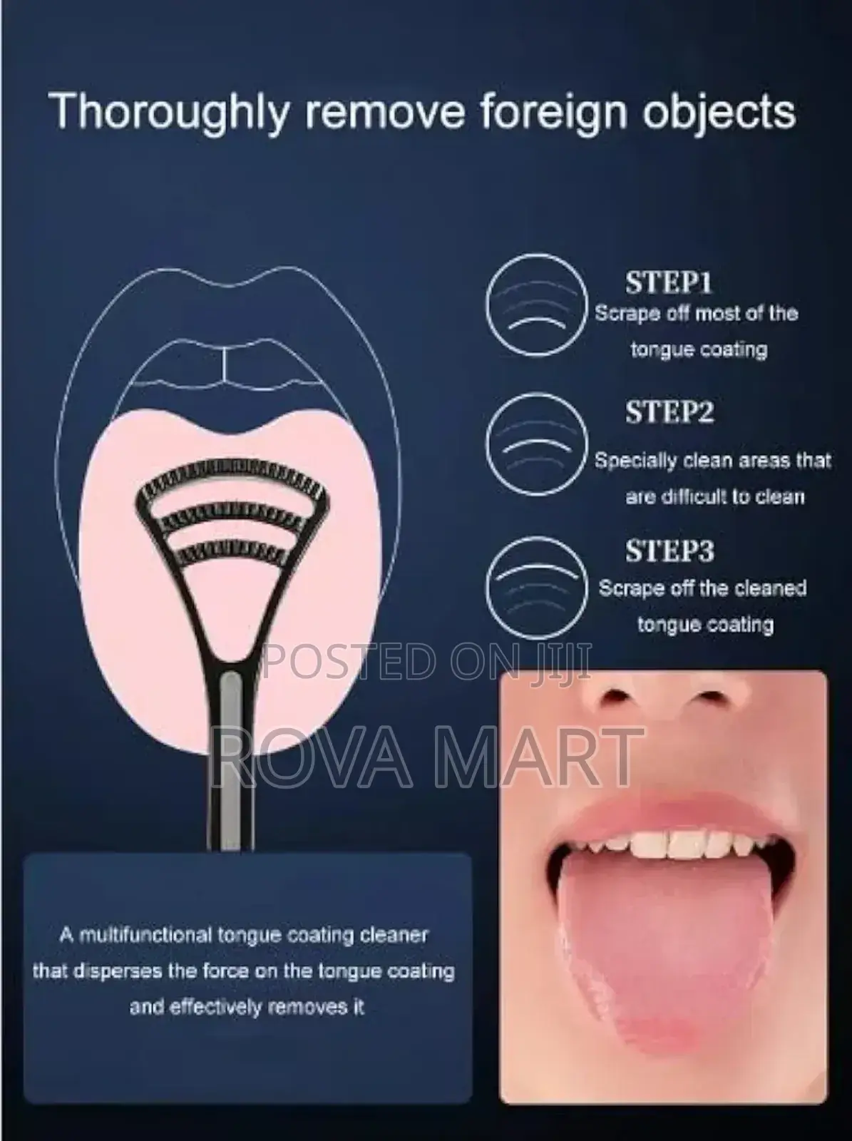 Tongue Cleaner