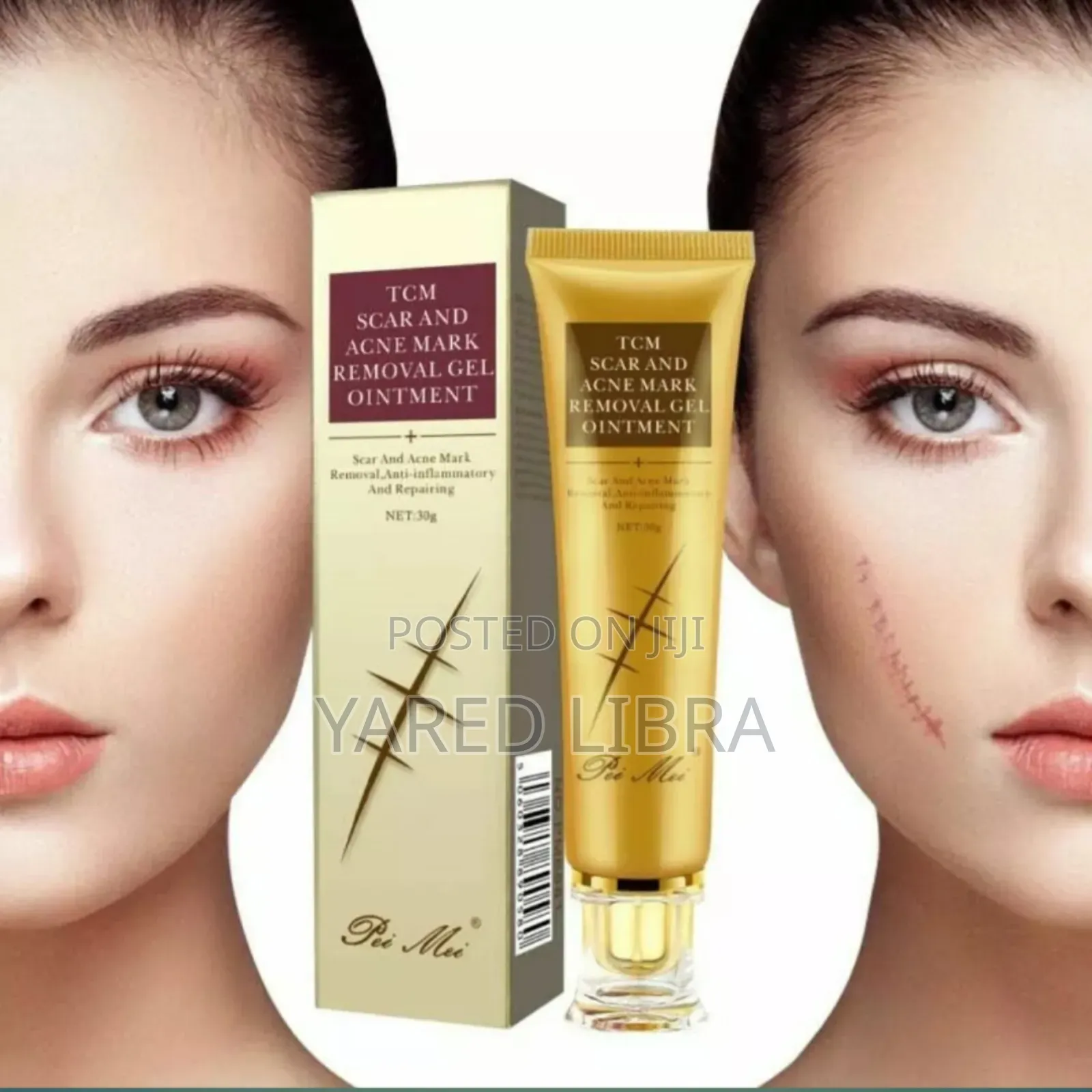 Lanbena ጠባሳ ማጥፊያ