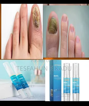 ጥፍሬ በለዘ ተነቀለ እያሉ እንዳይጨነቁ!