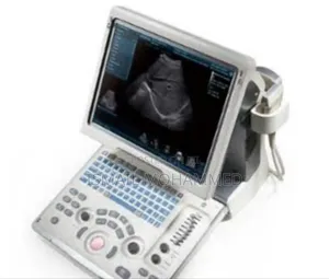 Mindray Dp- 50 Ultrasound