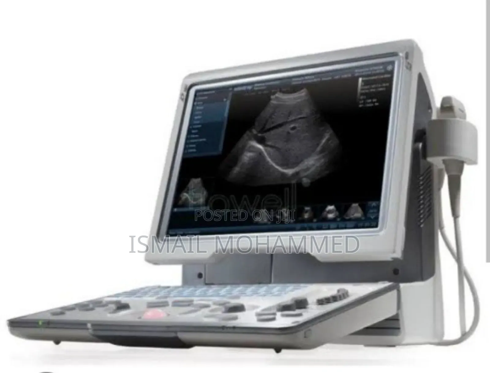 Mindray Dp- 50 Ultrasound