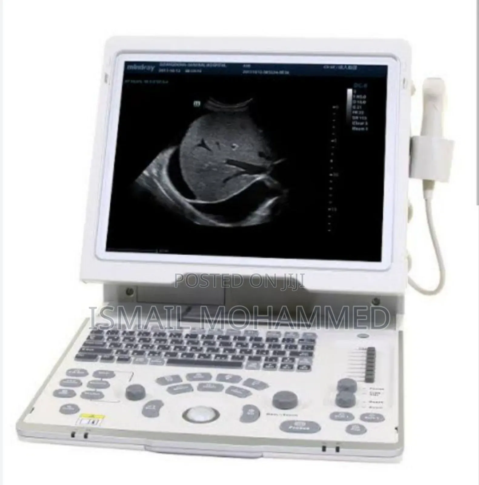Mindray Dp- 50 Ultrasound