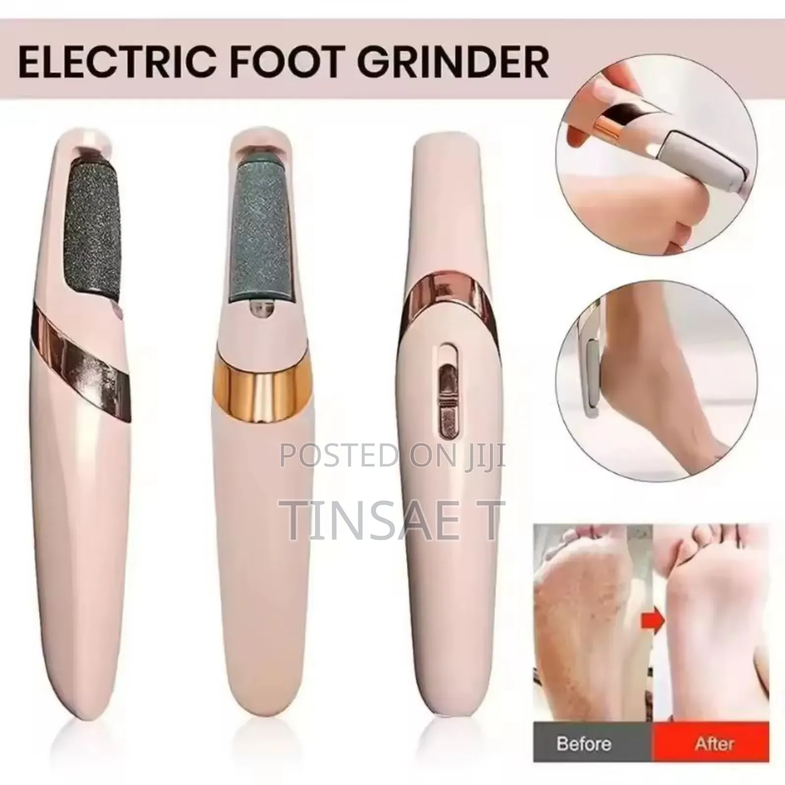 Electric Pedi Callous Remover/ለደረቅ ተረከዝ