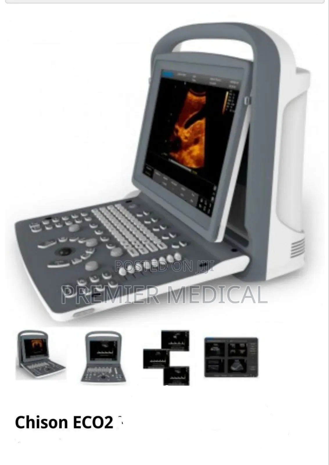 Chison Eco 2 Ultrasound